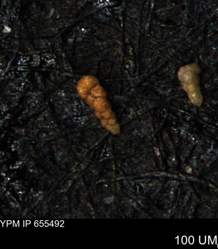 Verneuilina canadensis