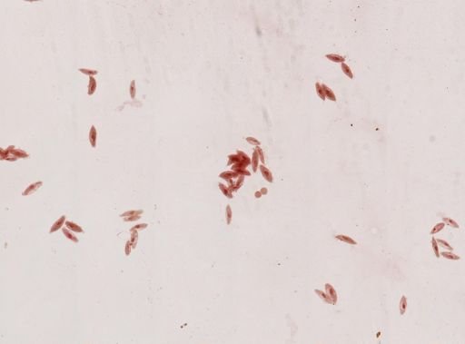 Paramecium caudatum