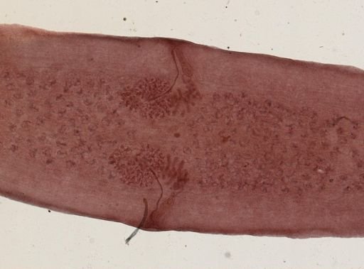 Dipylidium caninum