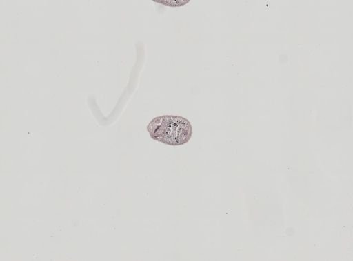 Plagiostomum whitmani