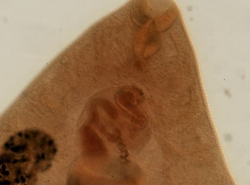 Fasciola hepatica