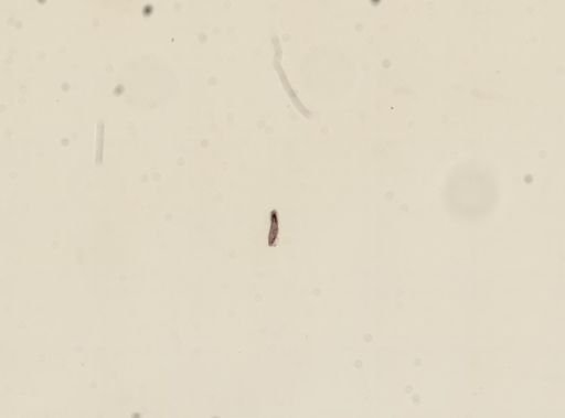 Paramecium caudatum