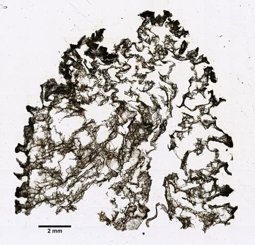 Fibularia anchorata