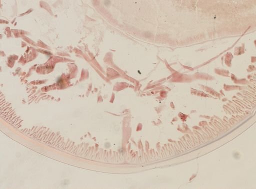 Ascaris megalocephala