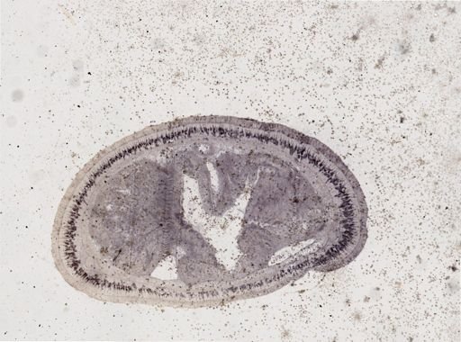 Lineus viridis