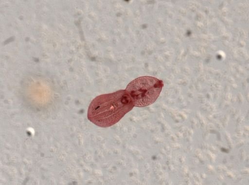 Posthodiplostomum minimum