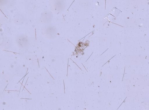 Suberites sp.