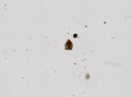 Hexarthra jenkinae