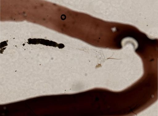 Dicrotendipes