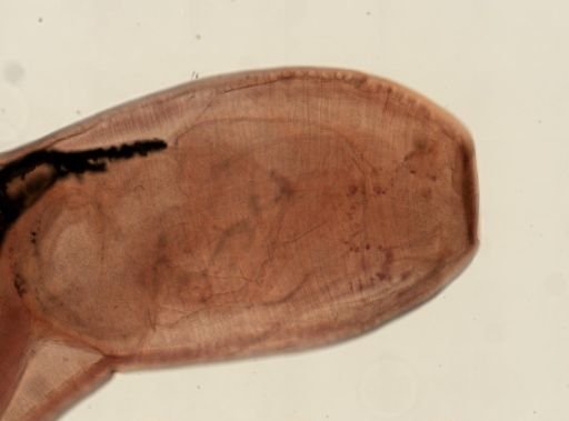 Oligacanthorhynchus microcephalus