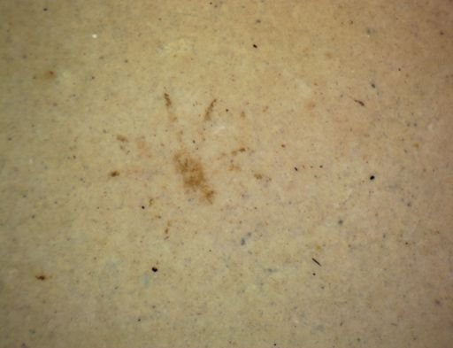 undet. Araneae