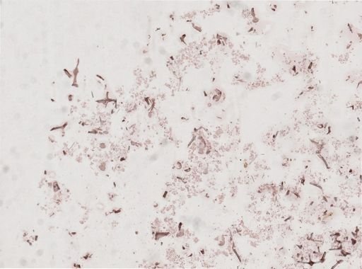 Haliclona oculata
