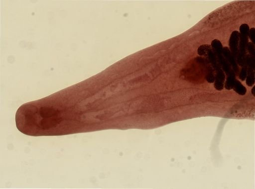 Clonorchis sinensis