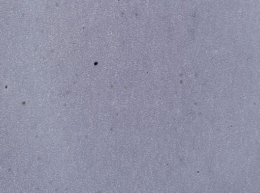 Plasmodium vivax