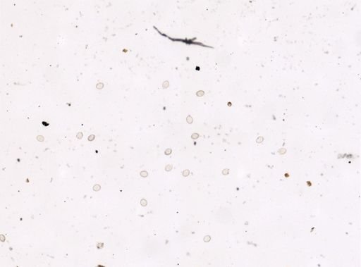 Diphyllobothrium erinacei