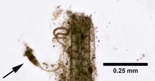 Collotheca heptabrachiata