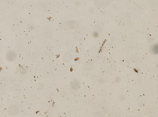 Diphyllobothrium canis