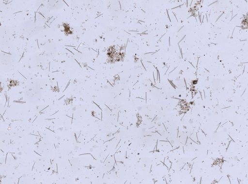 Isodictya deichmannae