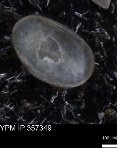 undet. Ostracoda