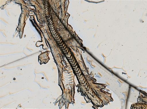 Galvina obesa