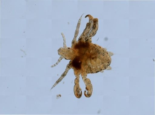 Pthirus pubis