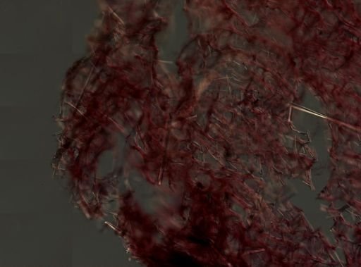 Callyspongia vaginalis