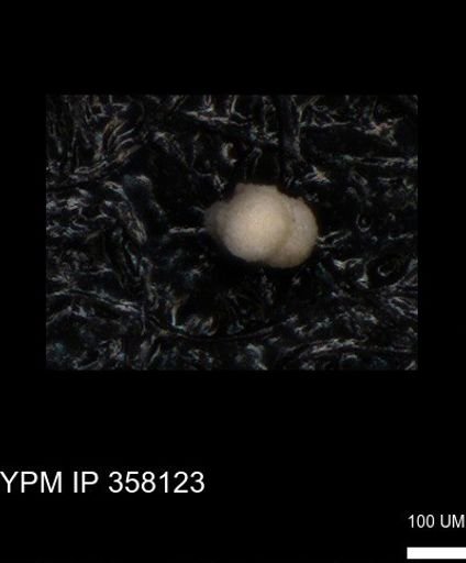 undet. Foraminiferida