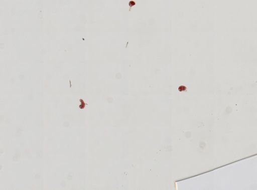 Trematoda
