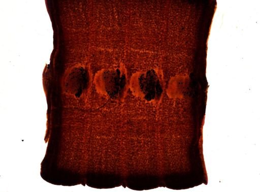 Diphyllobothrium erinacei