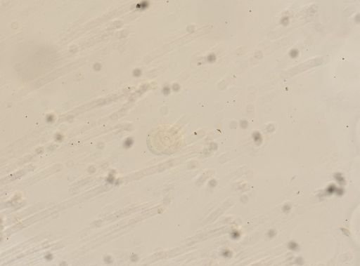 Trichinella spiralis