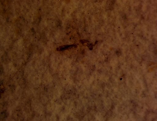 undet. Insecta