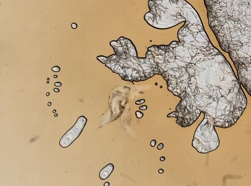 Calathura brachiata