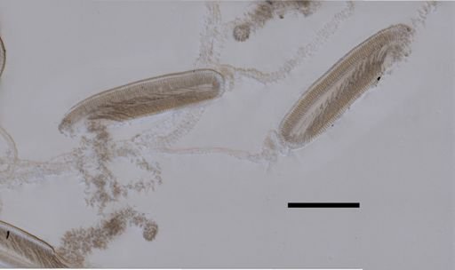 Stephanophyes superba