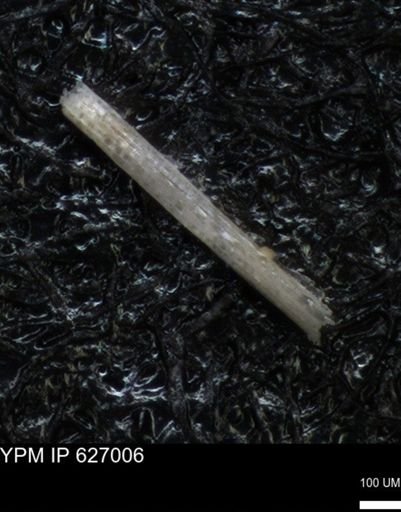 undet. Echinoidea