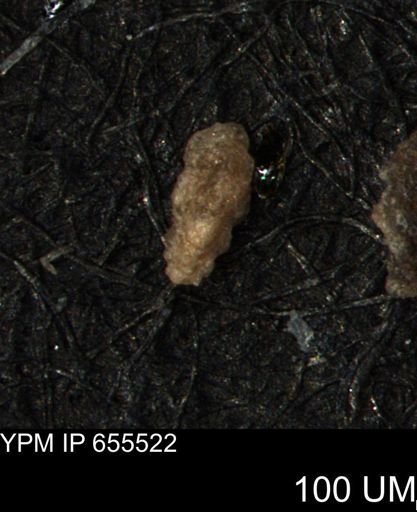 Verneuilina canadensis