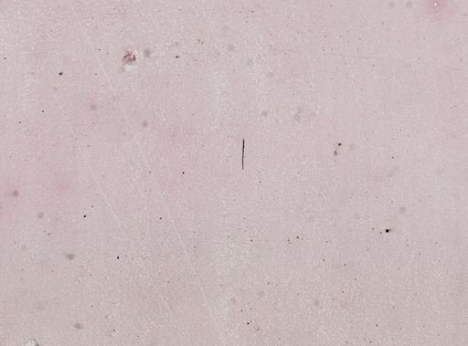 Trypanosoma cruzi