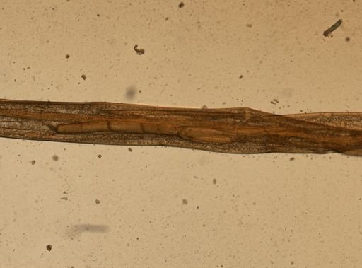 Enterobius vermicularis