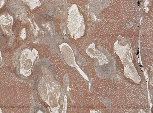 Taenia crassicollis