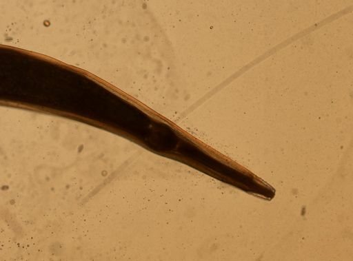 Enterobius vermicularis