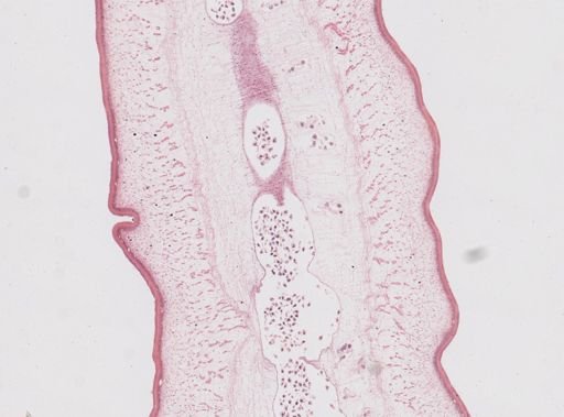 Taenia saginata