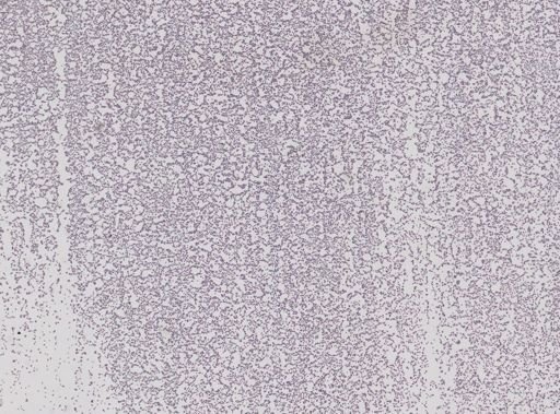 Plasmodium cathemerium