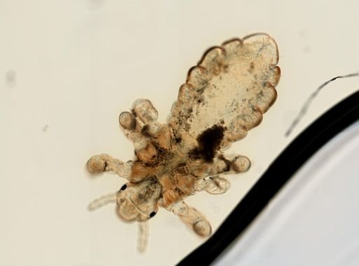 Pediculus humanus