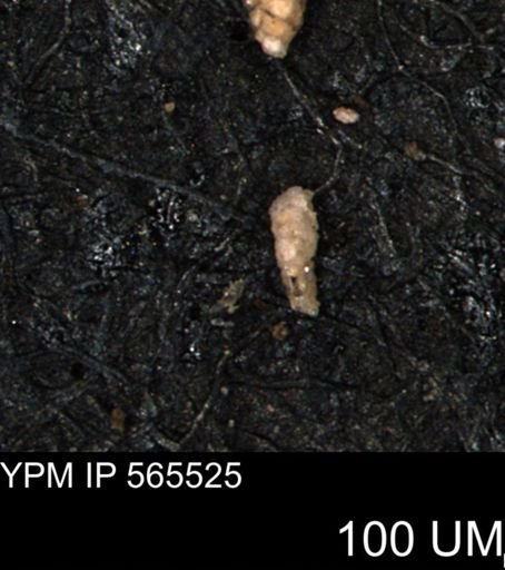 Verneuilina canadensis