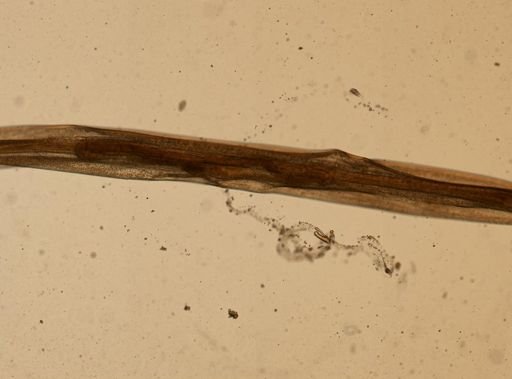 Enterobius vermicularis
