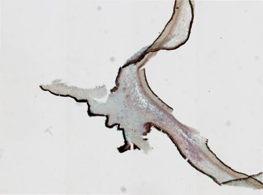 Fungi