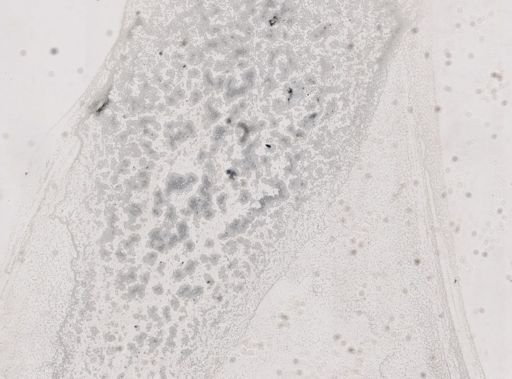 Microsporidia