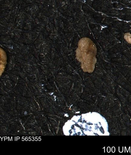 Verneuilina canadensis