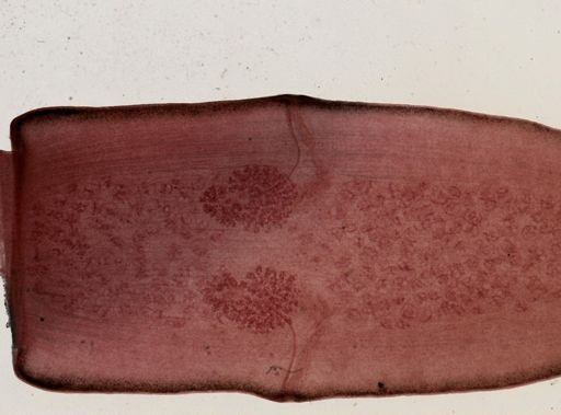 Dipylidium caninum