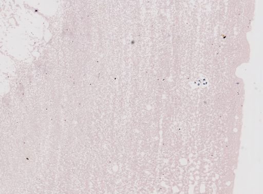 Plasmodium vivax