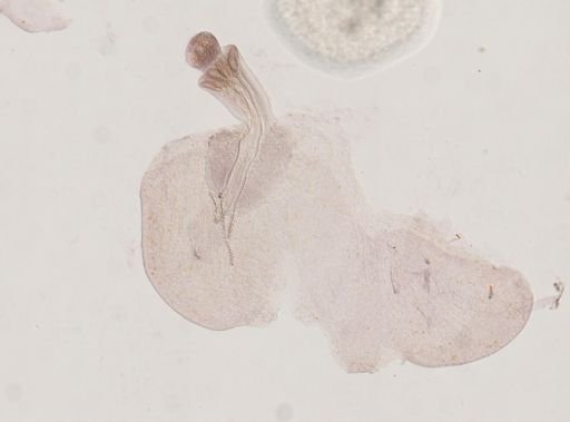 Otobothrium cysticum
